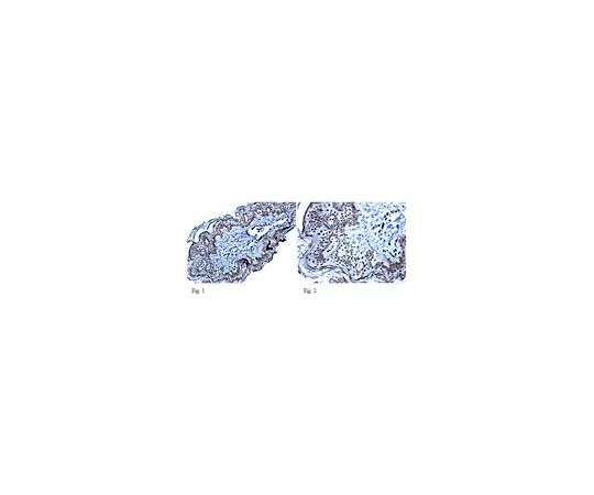 62-8465-25　［已停用］抗GPR56;100μg　ABN16