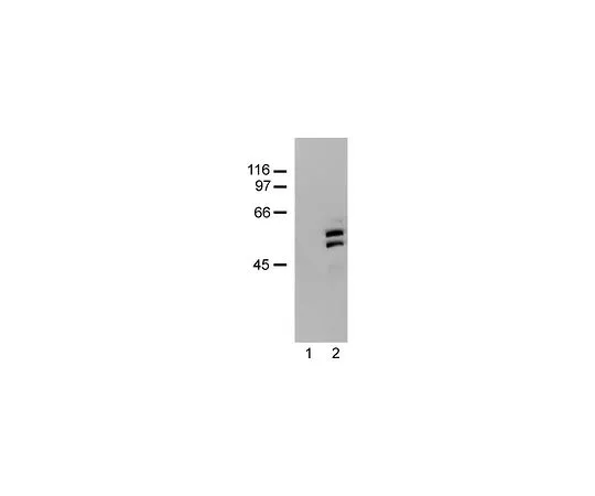 62-8381-13　［已停用］反SHC;250μg　06-203