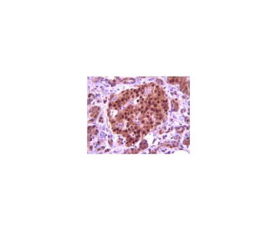 62-8383-42　［已停用］抗PDX1 (兔);100μL　06-1379