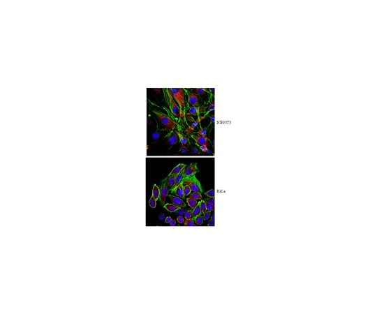 62-8493-94　［已停用］抗β-帕文，克隆11A5;100μg　MAB2620