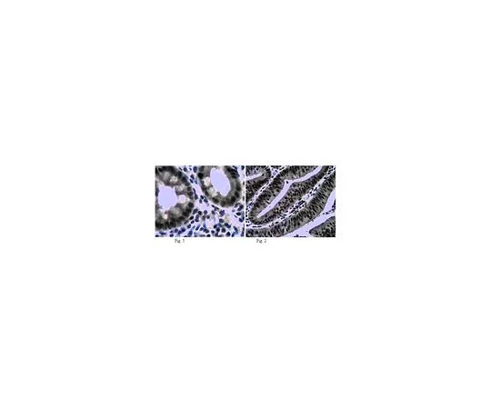 62-8459-37　［已停用］抗鹅膏 (GSC);100μg　ABD15