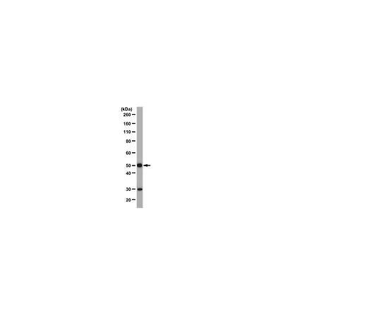 62-8389-26　［已停用］抗HLX1;100μg　09-084