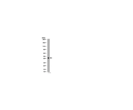 62-8452-33　［已停用］抗β-阿瑞斯汀2;100μg　AB6022