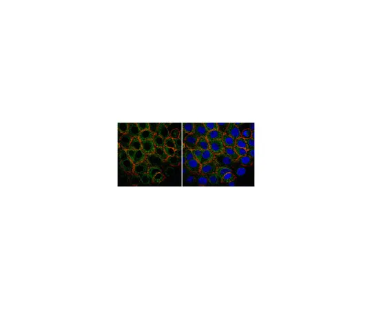 62-8375-31　［已停用］抗PI3激酶-C2-α，克隆9H4.2;100μg　05-1560
