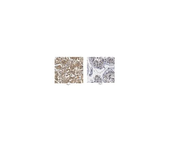 62-8458-37　［已停用］抗MAGEA3/MAGE3　ABC468