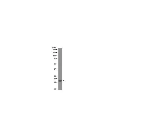 62-8392-89　［已停用］抗乙酰组蛋白H3,琼脂糖共轭;200μL　16-658