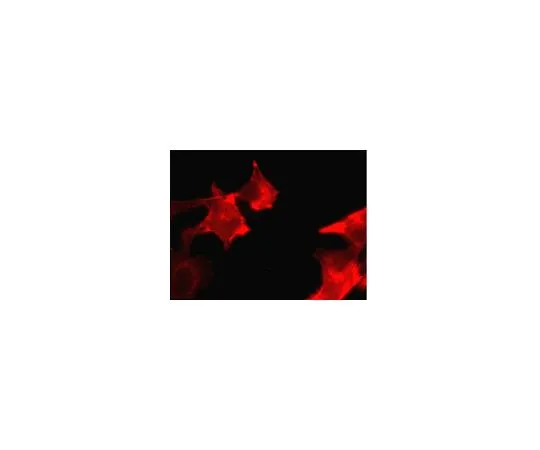 62-8394-57　［已停用］慢Brite (TM) RFP-Cortactin慢病毒生物传感器　17-10218