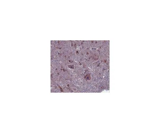 62-8465-79　［已停用］抗陶粒蛋白激酶2 (TTBK2);100μg　ABN103