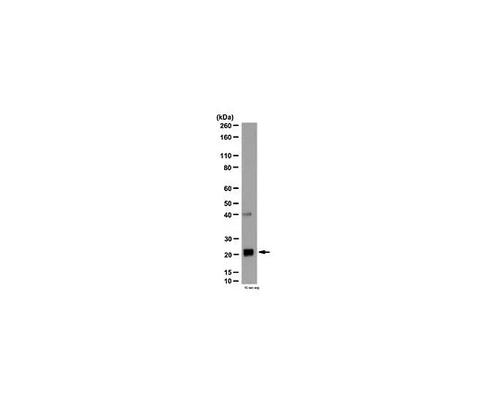 62-8465-53　［已停用］抗GPx1;100μg　ABN63