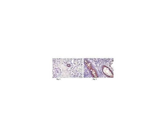 62-8472-50　［已停用］抗感染;100μg　ABT64
