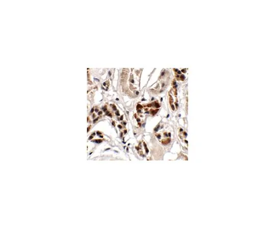 62-8464-92　［已停用］抗UHRF1BP1　ABF222