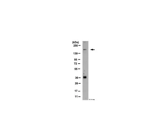 62-8389-33　［已停用］反磷猛禽 (Ser877);100μg　09-107