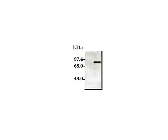 62-8448-30　［已停用］反PARP清除表单;50μg　AB3620