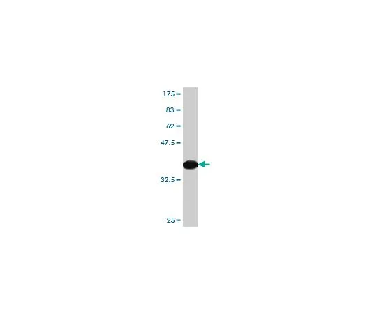 62-8477-60　［已停用］抗PON1小鼠mAb (2H7)　AP1155-100UG