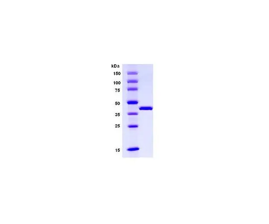 62-8426-86　［已停用］Lipocortin-II,他的Tag (R) 融合　437622-50UG