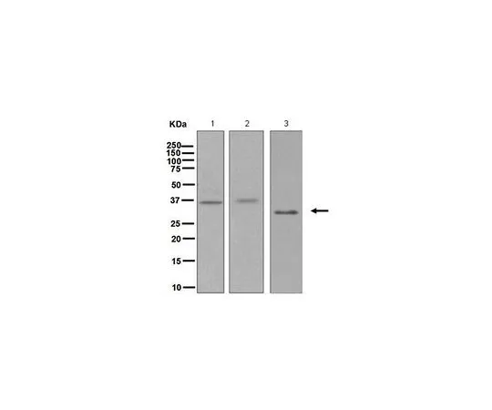 62-8503-06　［已停用］抗stanniocalcin-1,克隆EPR6055,兔单克隆　MABC738