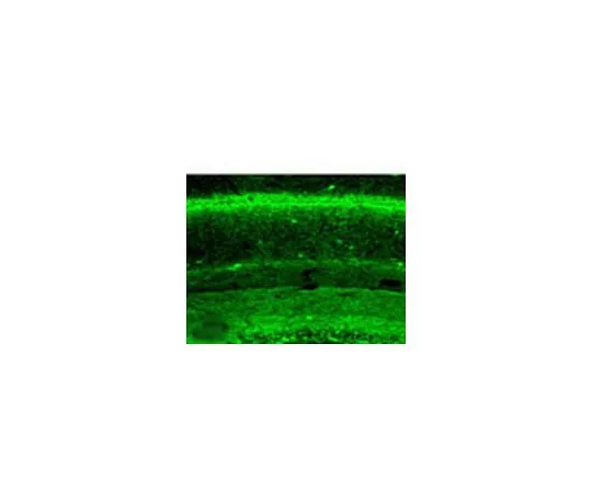 62-8411-40　［已停用］抗大麻素受体CB1 (1-77) 兔pAb　209550-100UL