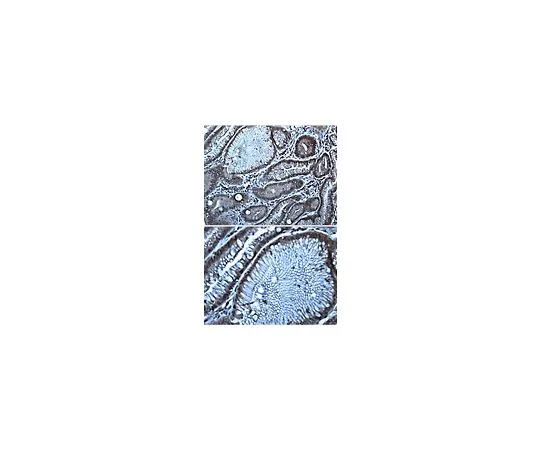 62-8501-03　［已停用］抗Dog1,克隆1.1;100μg　MABC36