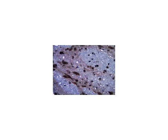 62-8516-55　［已停用］抗亨廷顿克隆4A4.2;100μg　MABN60