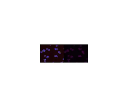 62-8500-45　［已停用］抗MGMT抗体，克隆MT 3.1, Alexa Fluor (R) 647共轭　MAB16200-AF647