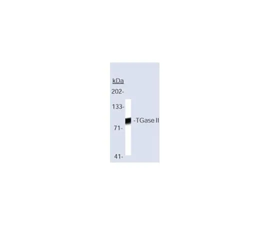 62-8441-60　［已停用］抗谷氨酰胺酶II兔pAb　616465-500UL