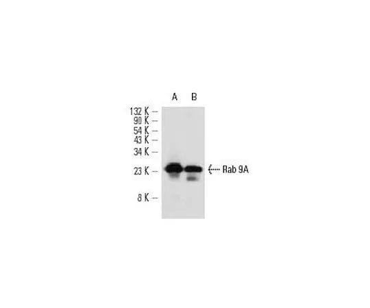 62-8436-47　［已停用］抗Rab9小鼠mAb (mab9)　552101-100UL