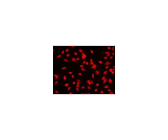 62-8528-21　［已停用］抗复制蛋白A (Ab-3) 小鼠mAb (RPA34-20)　NA19L-100UG