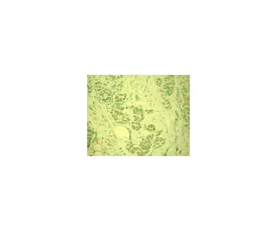 62-8529-41　［已停用］抗MDM2 (Ab-6) 小鼠mAb (5B10C)　OP146-100UG