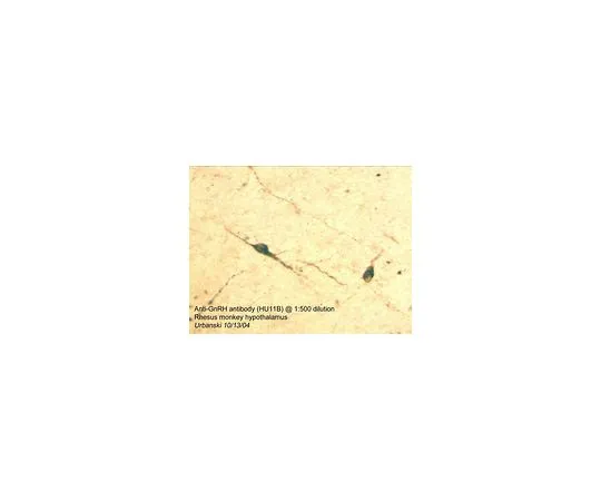 62-8498-01　［已停用］抗促性腺激素释放激素，N末端，克隆HU11B;100μL　MAB5456