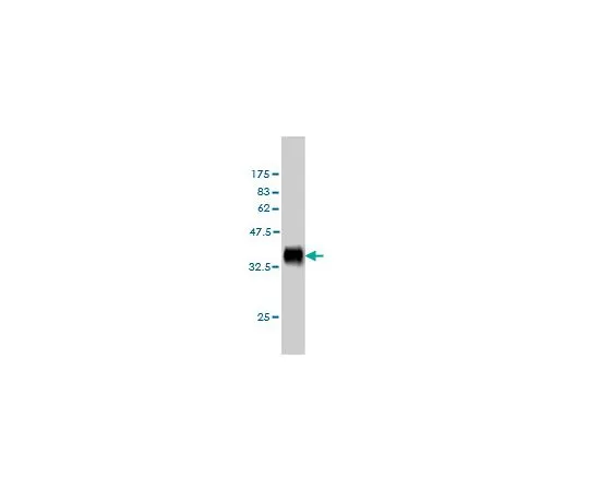 62-8534-15　［已停用］抗DLL1小鼠mAb (4F8)　ST1703-100UG