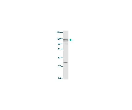 62-8481-52　［已停用］抗MSH6小鼠mAb (1F2)　DR1106-100UG