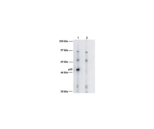 62-8529-57　［已停用］抗p53 (Ab-7) (泛热带) 绵羊pAb　PC35-1EA