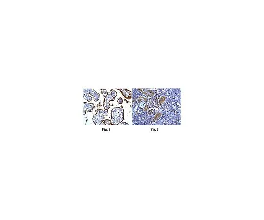 62-8512-52　［已停用］抗CD59,克隆EPR6425 (2) ，兔单克隆　MABF754