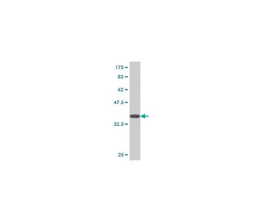 62-8533-81　［已停用］抗ADAMTS1小鼠mAb (1B8)　ST1604-100UG