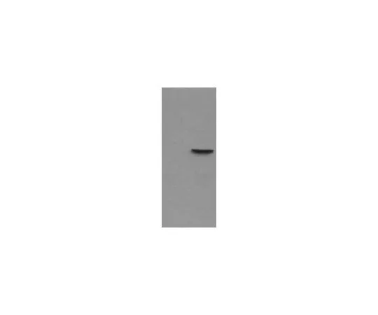 62-8443-28　［已停用］磷检测 (TM) 抗VASP (pSer239) 小鼠mAb (16C2)　676602-100UG