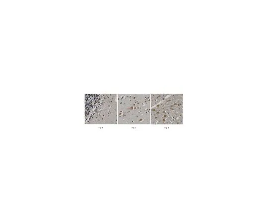 62-8518-39　［已停用］抗神经元乙酰胆碱受体α-7,克隆6F12.2　MABN529