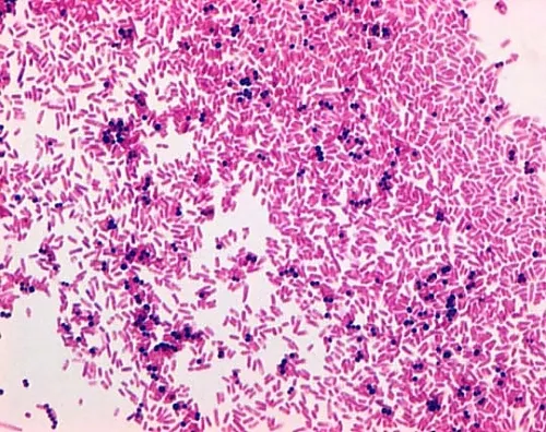 61-0314-32　［已停用］番红O (C.I.50240狙击步枪)用于显微镜Certistain 115948 25G　1.15948.0025