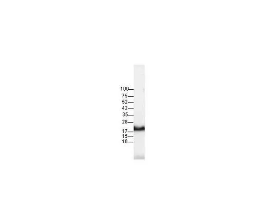 62-8528-97　［已停用］抗c-N-ras (Ab-1) 小鼠mAb (F155-227)　OP25-100UG