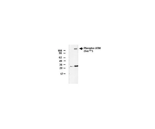 62-8481-26　［已停用］PhosphoDetect (TM) Anti-ATM (pSer1981) Mouse mAb (10H11.E12)　DR1002-50UG