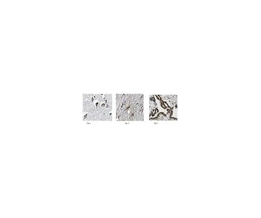 62-8517-58　［已停用］抗Tachikinin-3,克隆15D9.1　MABN370