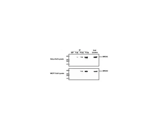 62-8478-62　［已停用］抗BRCA2兔pAb　CA1033-100UG