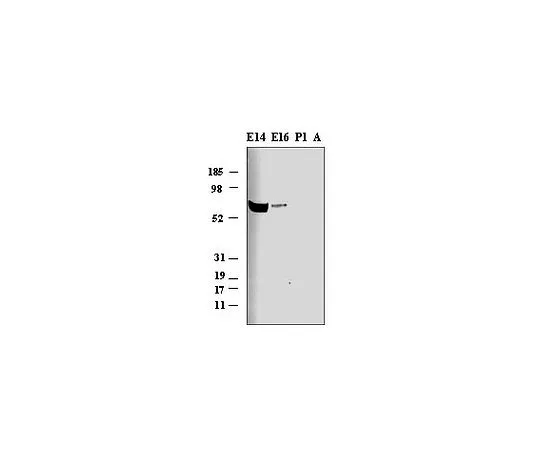 62-8529-84　［已停用］抗肿瘤蛋白-1 (Ab-1) (497-508) 兔pAb　PC344-100UG