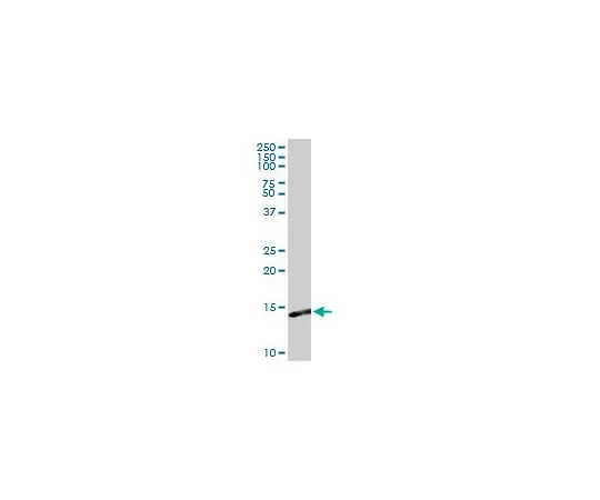 62-8478-76　［已停用］抗S100A9兔pAb　CB1022-100UG