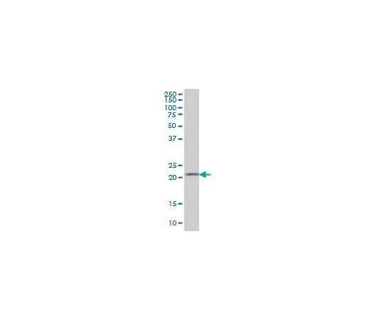62-8534-19　［已停用］抗DFHR小鼠mAb (2B10)　ST1711-100UG