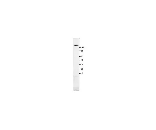 62-8529-29　［已停用］抗mTOR/FRAP (Ab-2) 小鼠mAb (22C2)　OP97-100UG