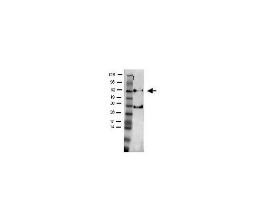 62-8481-30　［已停用］抗Plk1小鼠mAb (35-206)　DR1037-50UG
