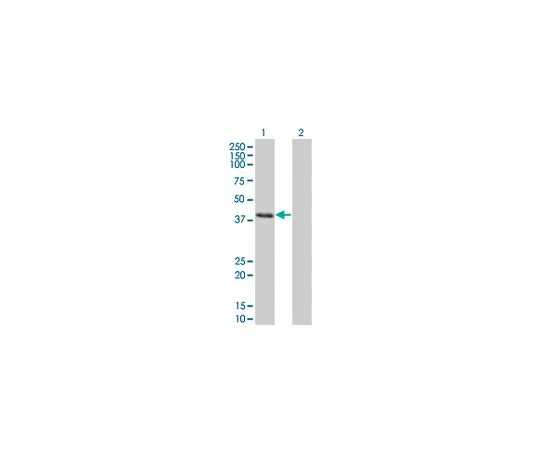 62-8533-60　［已停用］抗CLN3小鼠mAb (1G10)　ST1523-100UG