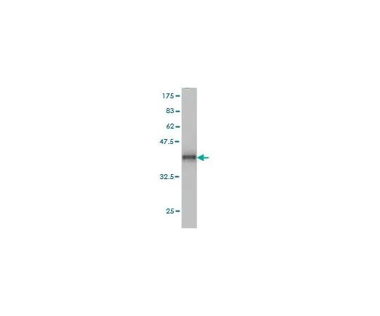 62-8533-79　［已停用］抗ADAM12小鼠mAb (1G3)　ST1600-100UG