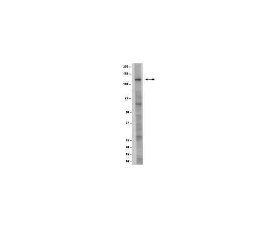 62-8498-30　［已停用］抗NMDAR2C;100μL　MAB5576