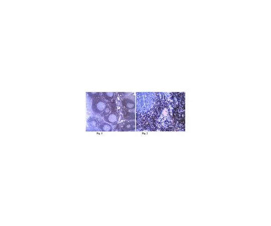 62-8525-41　［已停用］抗胸腺素β-4,克隆1H2.1;100μL　MABT77